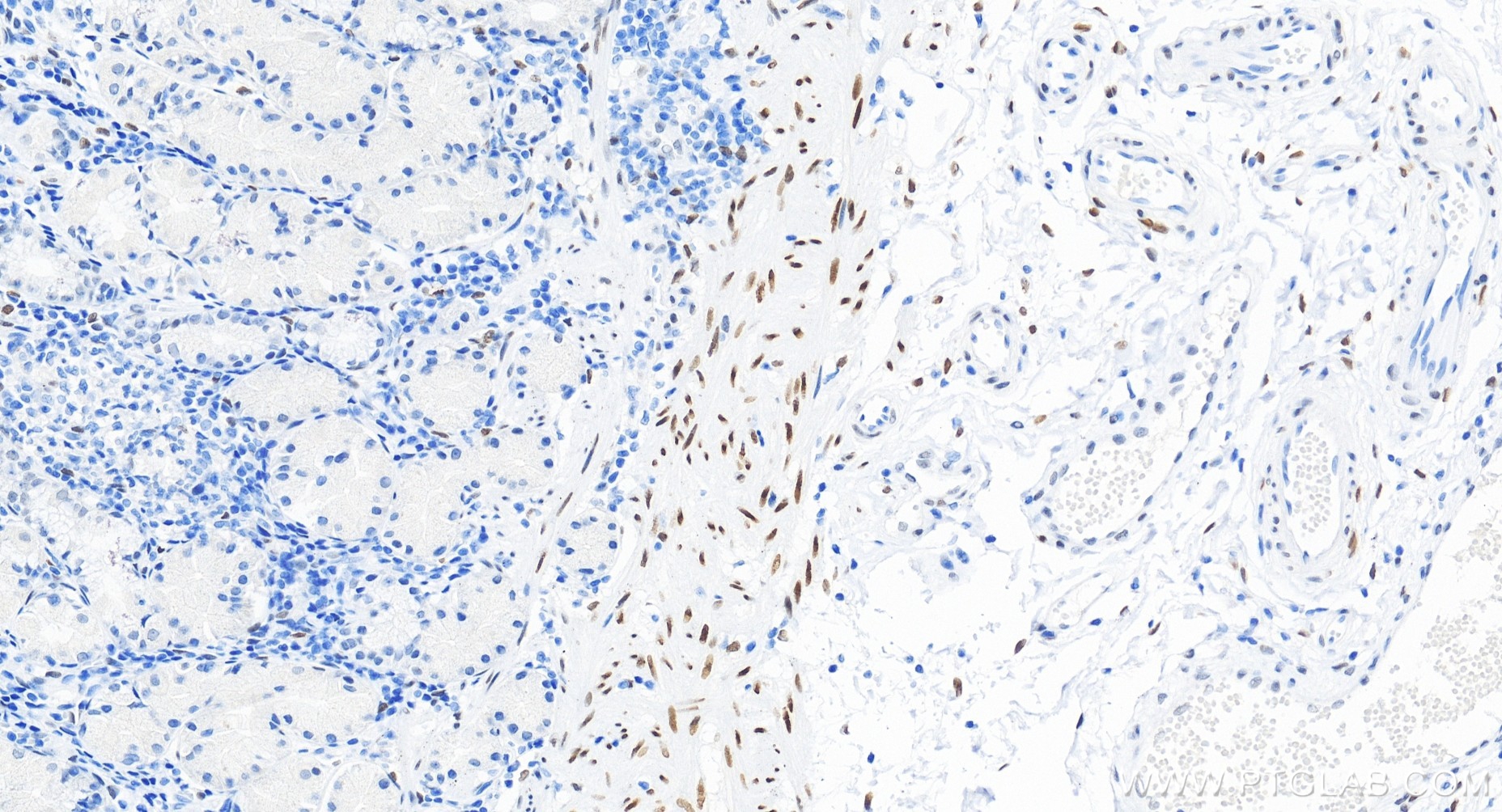 Immunohistochemical analysis of paraffin-embedded human stomach tissue slide using 86504-3-RR (PBX1 antibody) at dilution of 1:500 (under 20x lens). Heat mediated antigen retrieval with Tris-EDTA buffer (pH 9.0). IHC staining of human stomach using 86504-3-RR