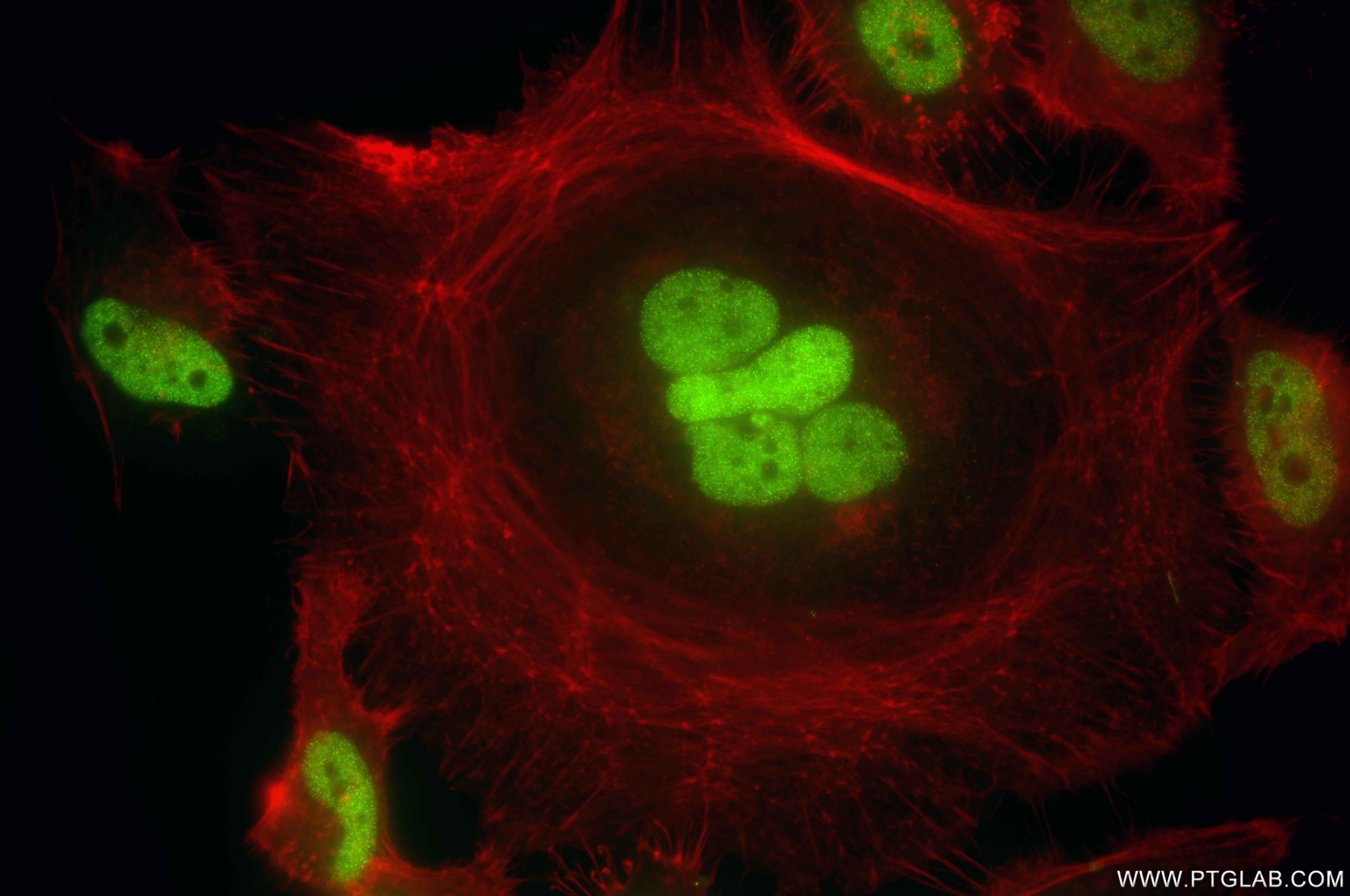 Immunofluorescent analysis of (4% PFA) fixed HeLa cells using PBX1 antibody (86504-3-RR, Clone: 251373B4 ) at dilution of 1:800 and CoraLite®488-Conjugated Goat Anti-Rabbit IgG(H+L) (<a class='green' href='/productredirect?CatalogNo=SA00013-2' target='_blank'>SA00013-2</a>), CL594-Phalloidin (red). IF Staining of HeLa using 86504-3-RR