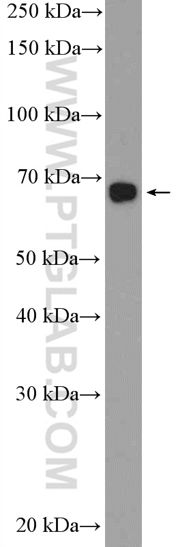 PBX2 Polyclonal antibody