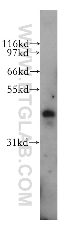 PBX3 Polyclonal antibody