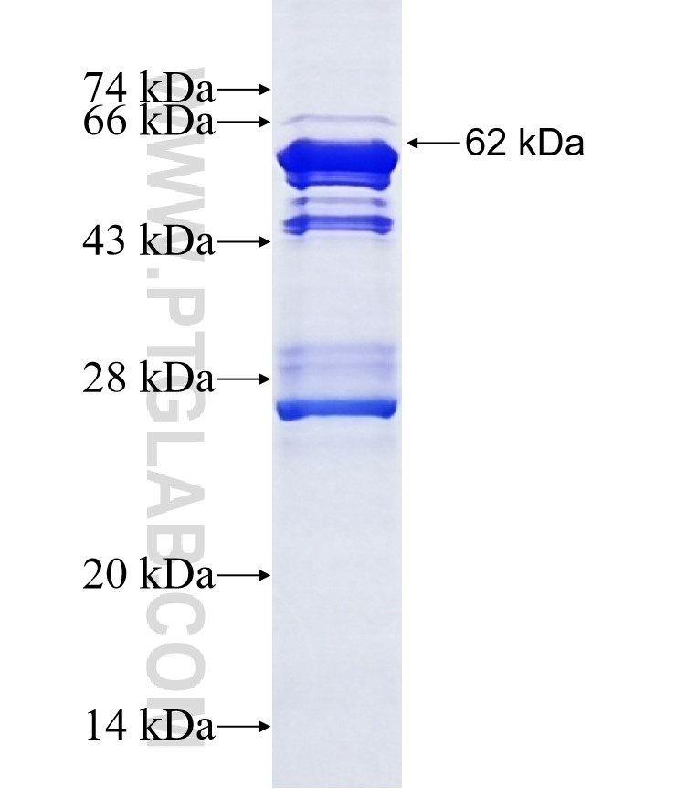 PBX3 fusion protein Ag3239 SDS-PAGE