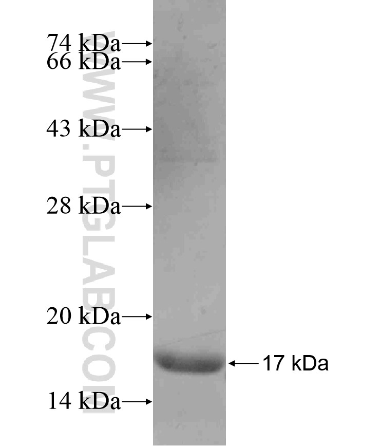 PBX4 fusion protein Ag17862 SDS-PAGE PBX4 fusion protein Ag17862 SDS-PAGE