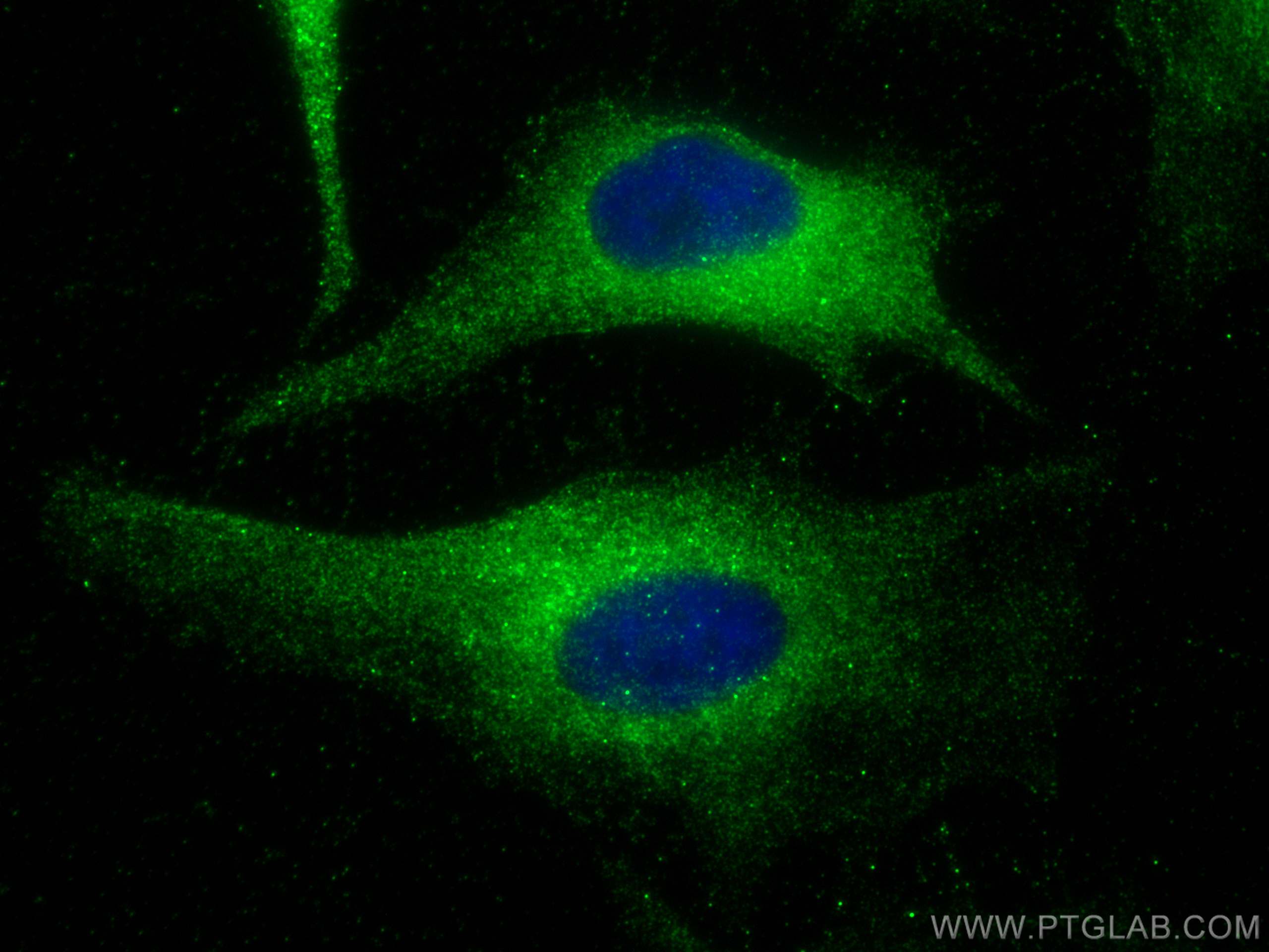 IF Staining of HeLa using 12102-1-AP