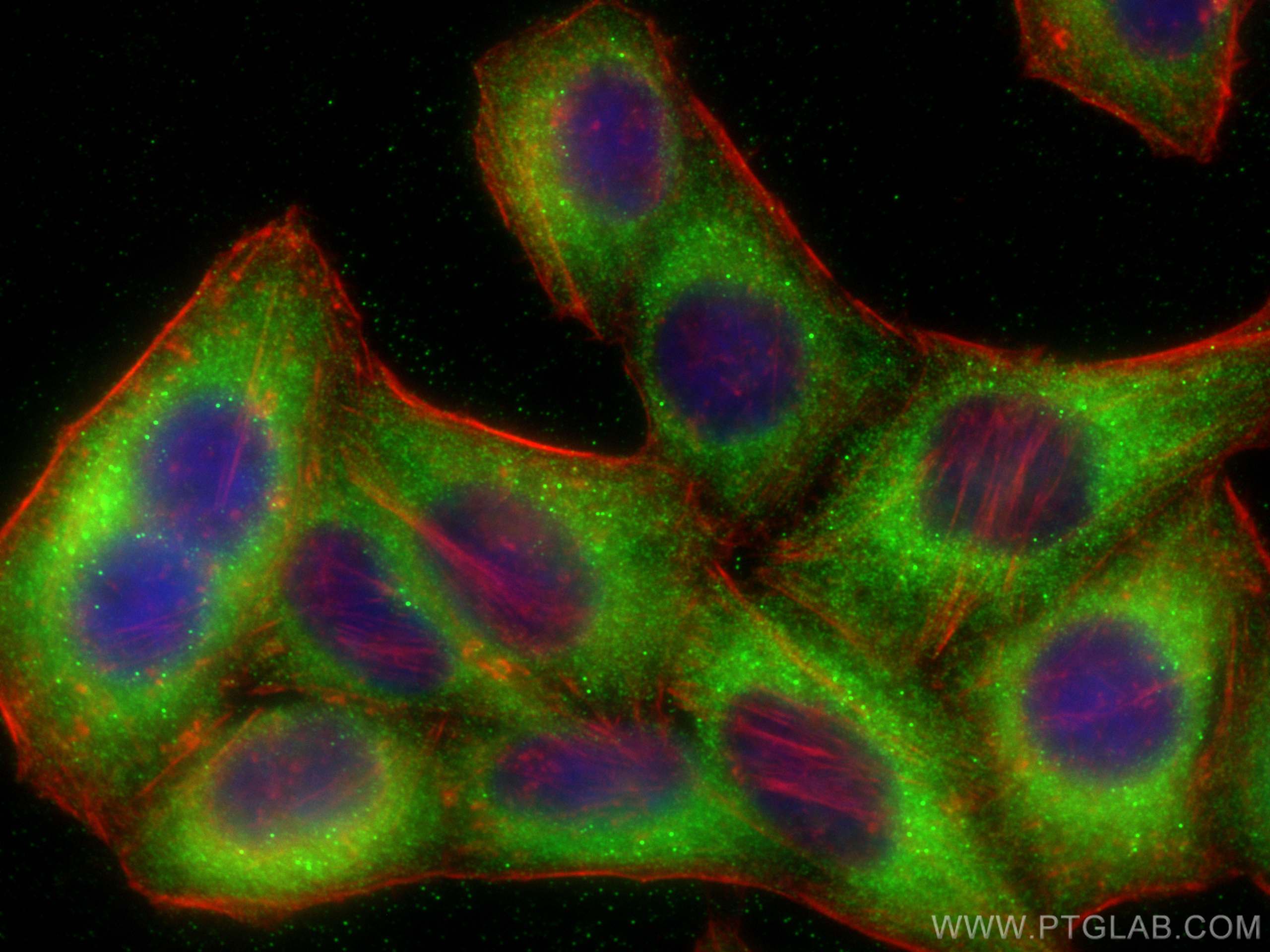 IF Staining of HepG2 using 12102-1-AP