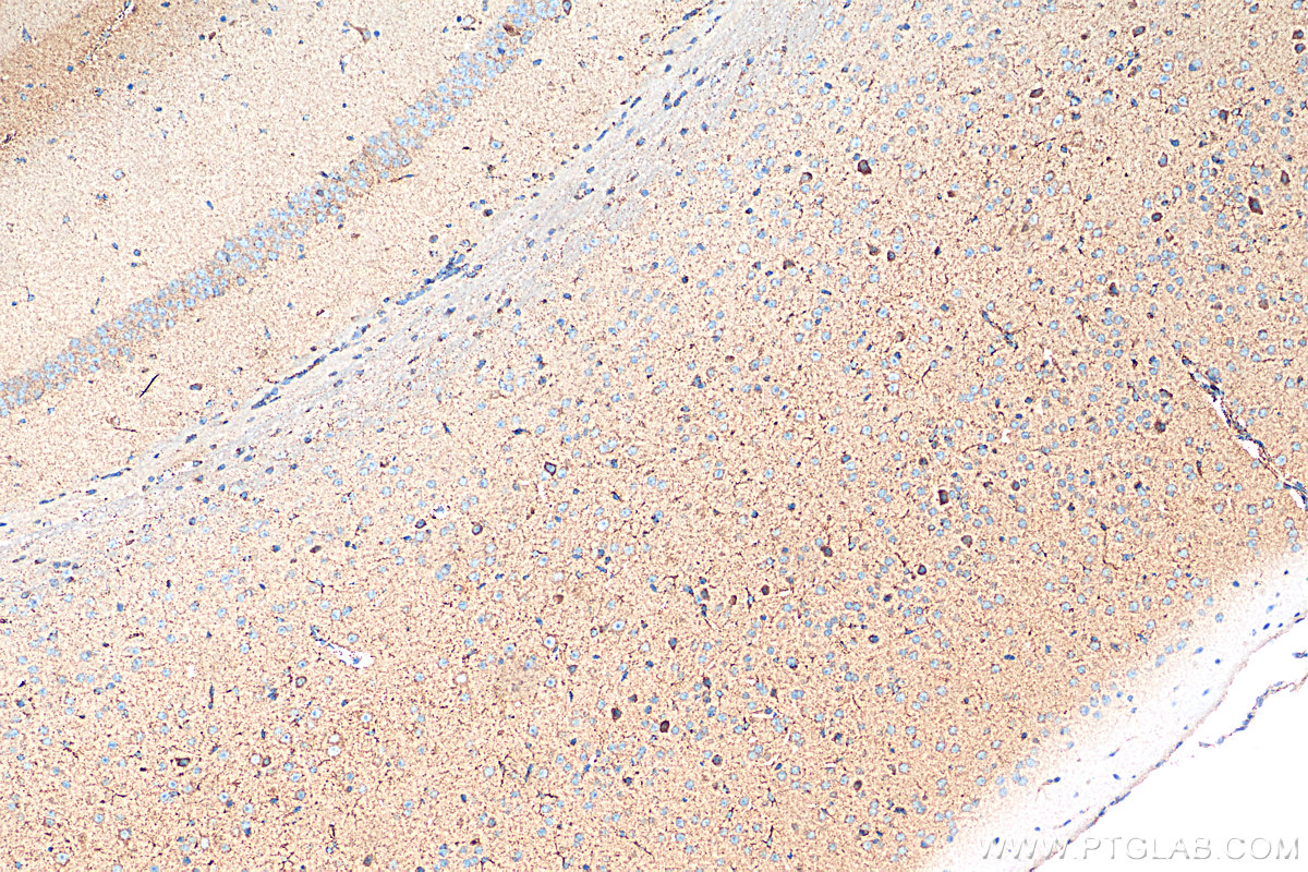 IHC staining of mouse brain using 66615-1-Ig