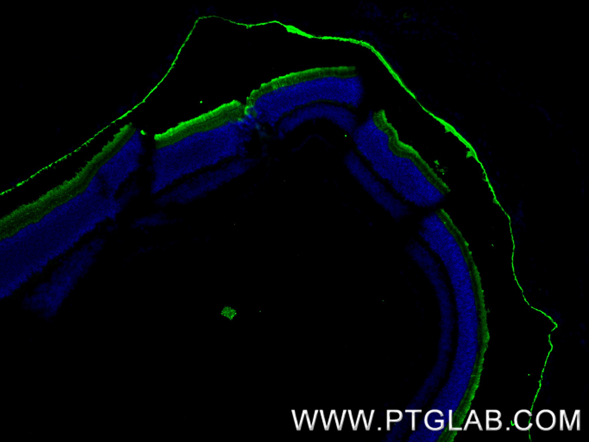 IF Staining of mouse eye using 83364-4-RR