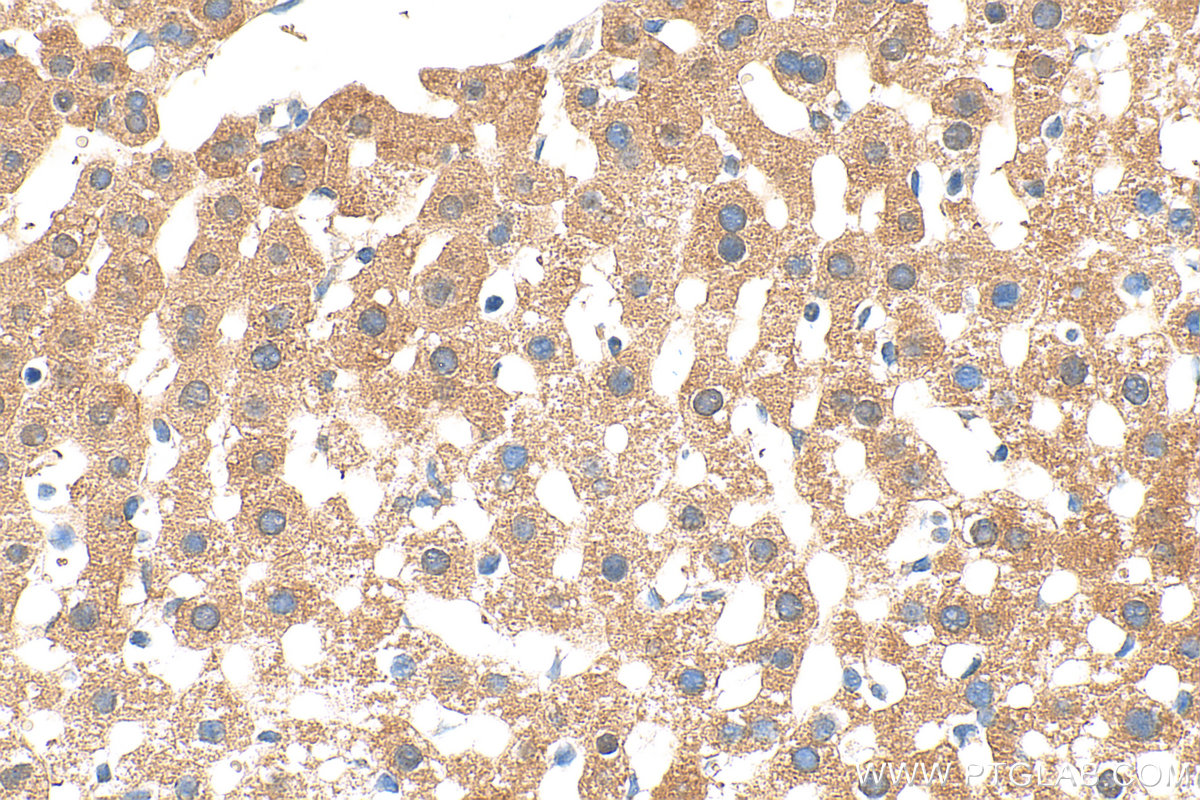IHC staining of mouse liver using 15702-1-AP