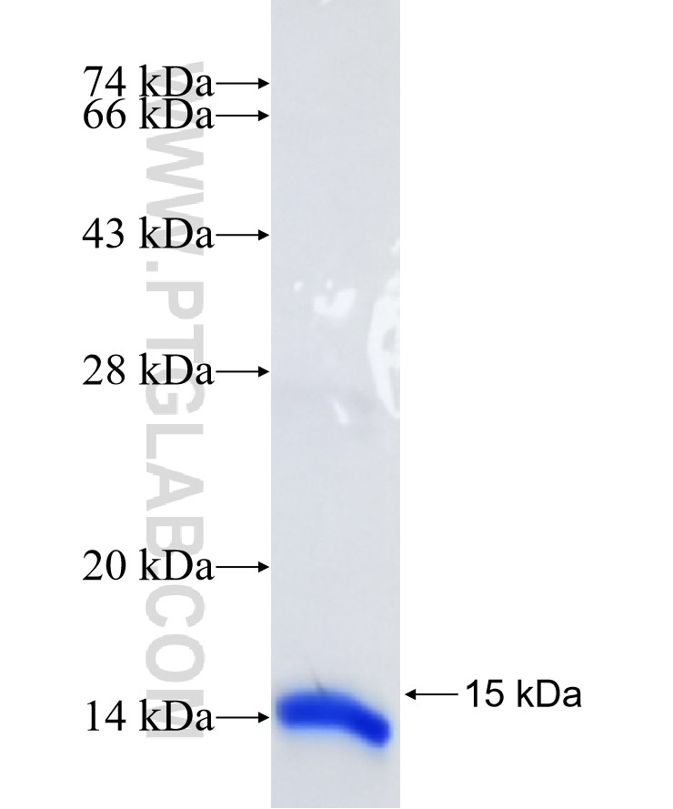 PCBD1 fusion protein Ag8426 SDS-PAGE PCBD1 fusion protein Ag8426 SDS-PAGE