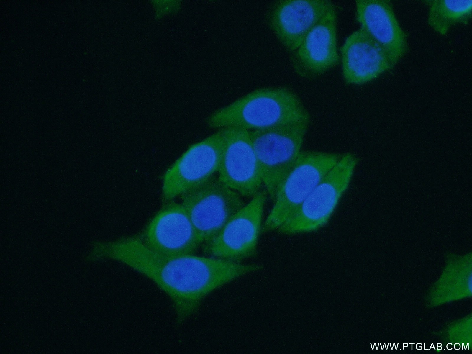 IF Staining of HeLa using 15070-1-AP