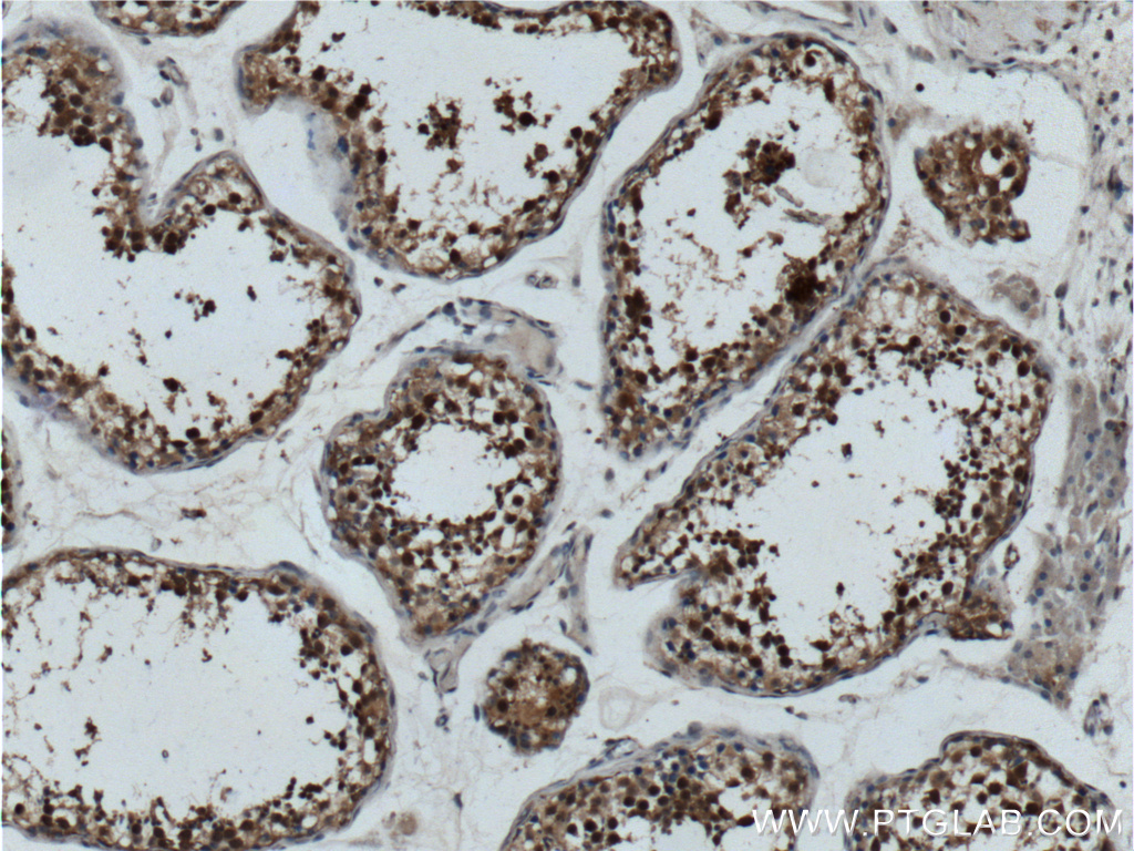 IHC staining of human testis using 15070-1-AP