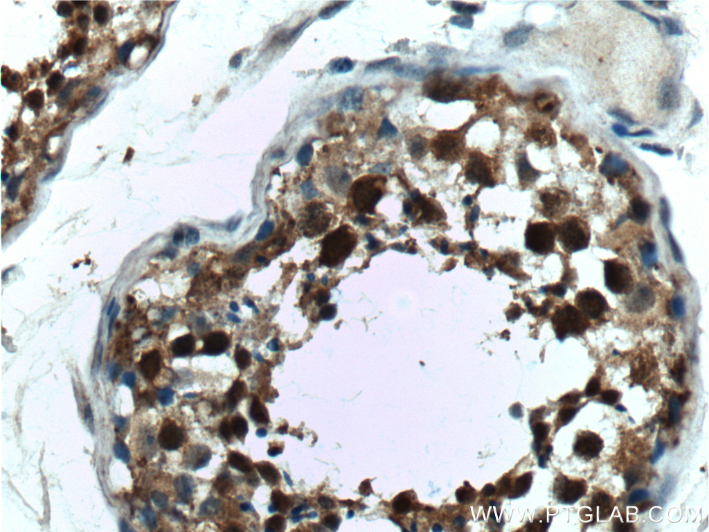 IHC staining of human testis using 15070-1-AP