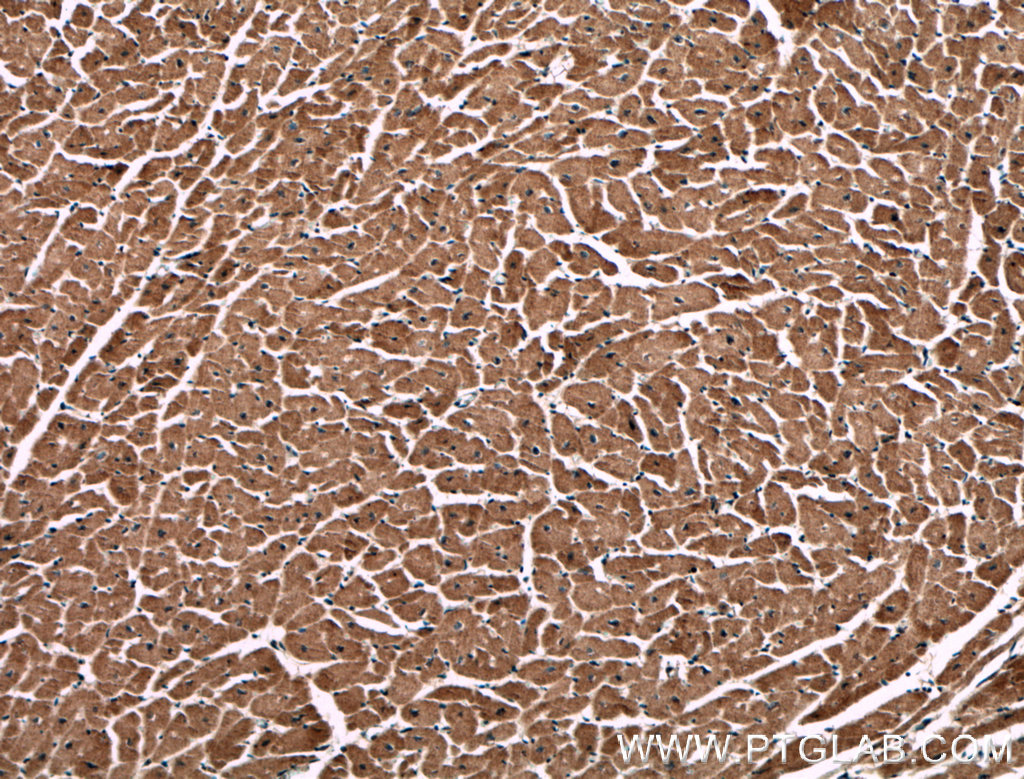 IHC staining of human heart using 66501-1-Ig (same clone as 66501-1-PBS)