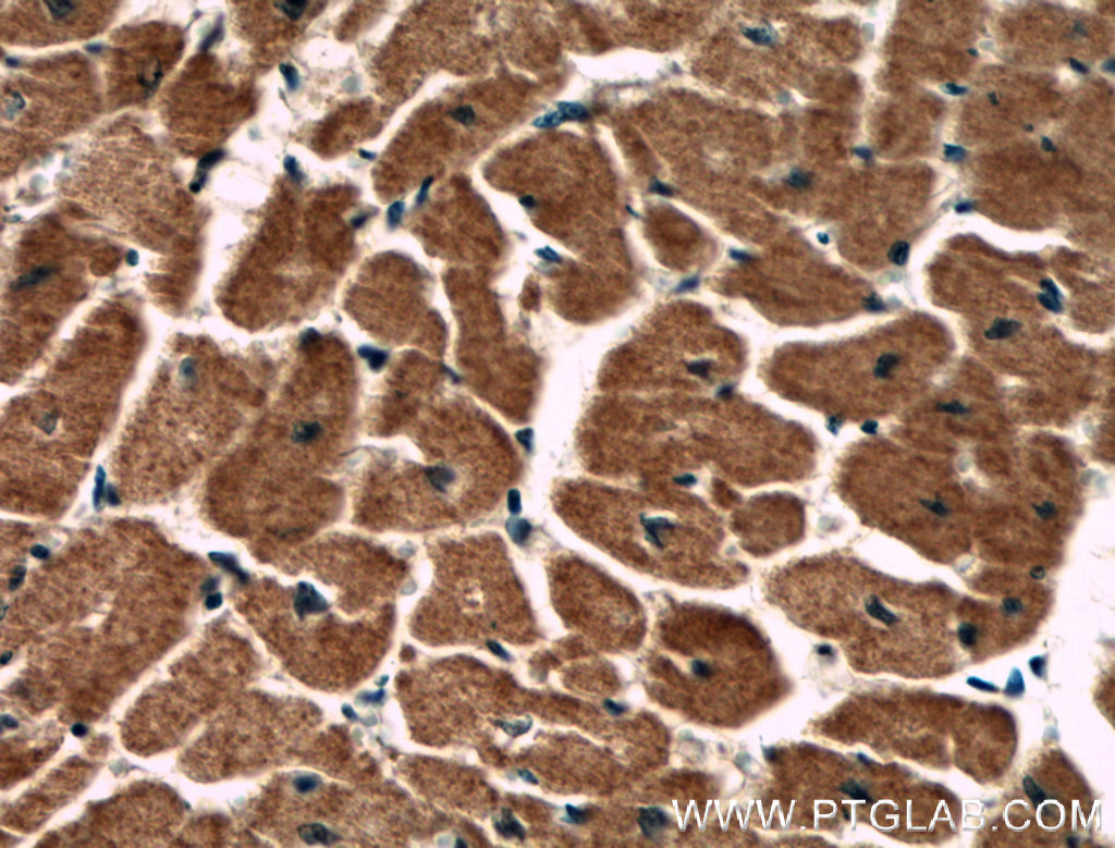 IHC staining of human heart using 66501-1-Ig (same clone as 66501-1-PBS)