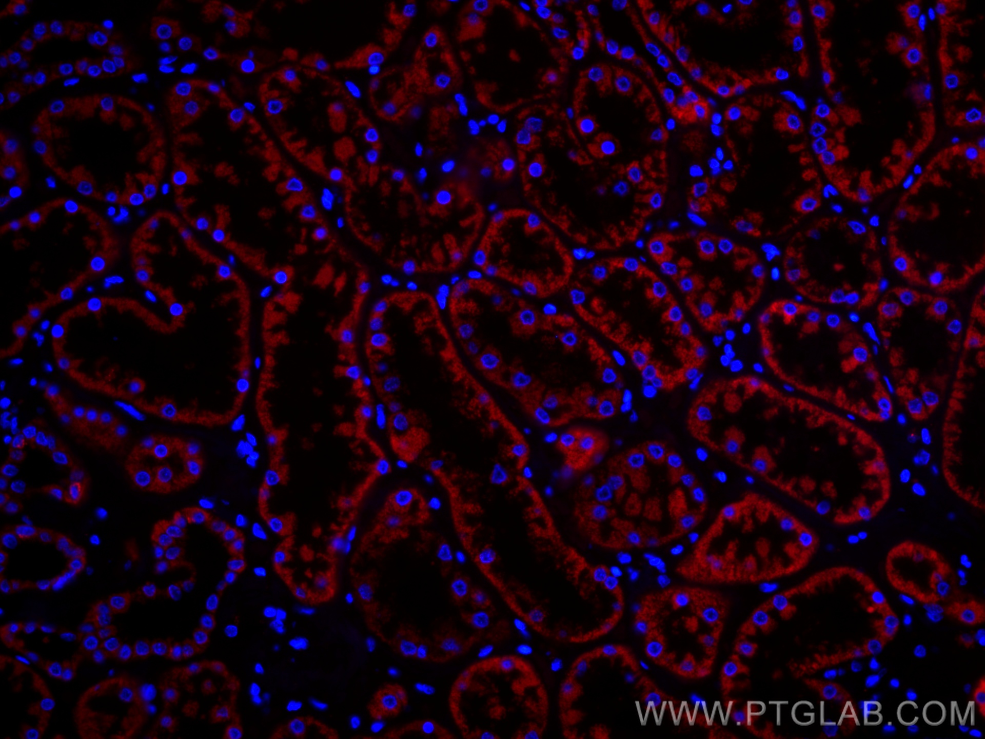 IF Staining of human kidney using CL594-66501