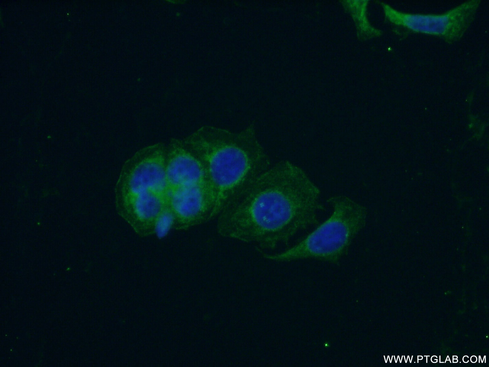 IF Staining of PC-3 using 21859-1-AP (same clone as 21859-1-PBS)