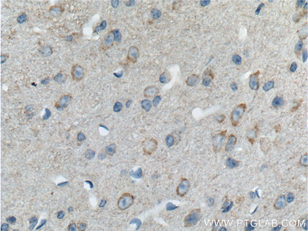 IHC staining of mouse brain using 21859-1-AP (same clone as 21859-1-PBS)
