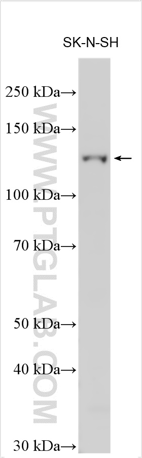 WB analysis using 21859-1-AP (same clone as 21859-1-PBS)