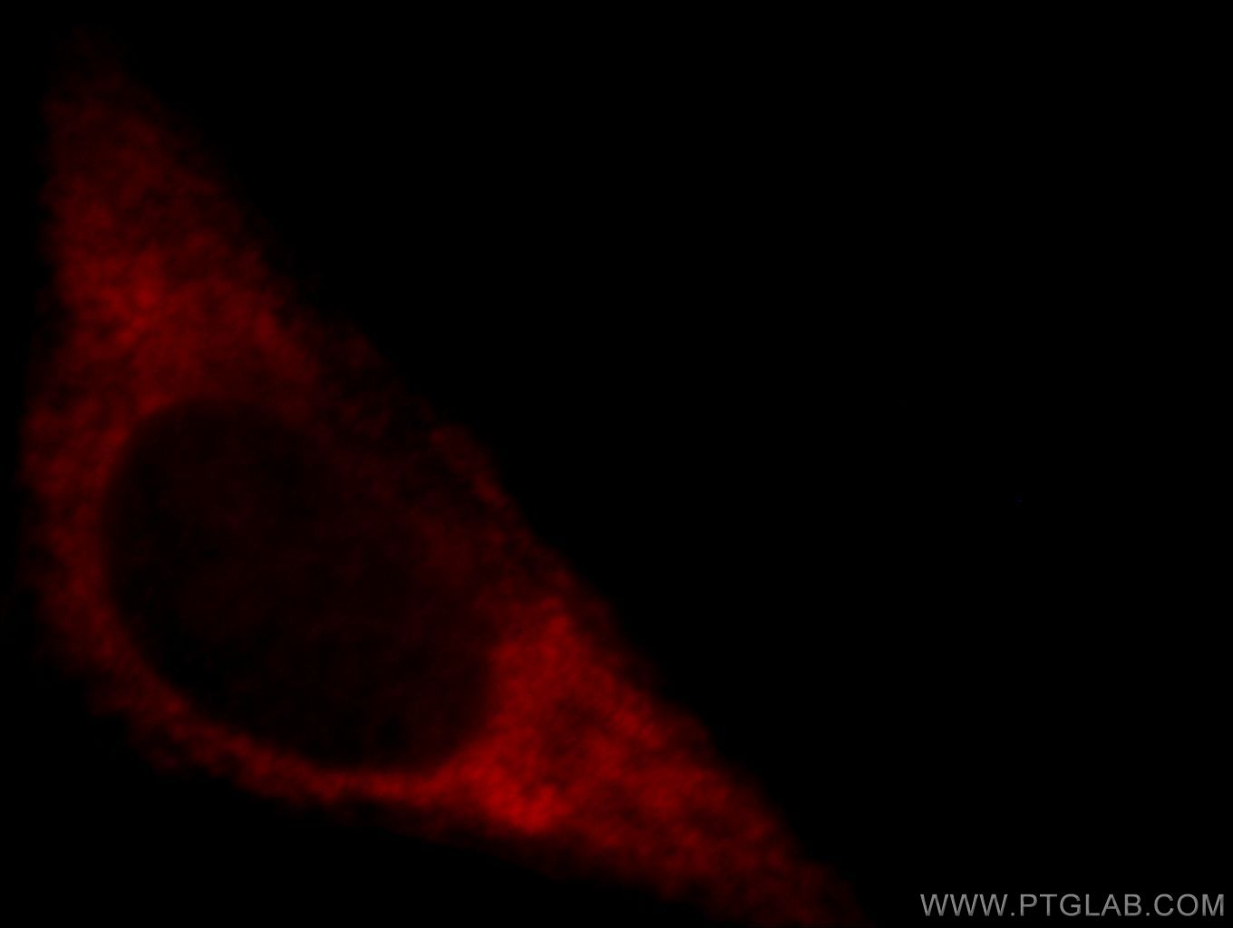 IF Staining of HepG2 using 20070-1-AP