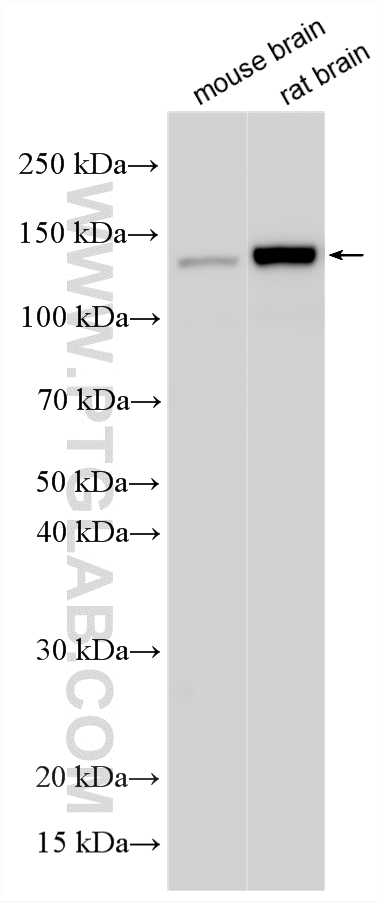 Various lysates were subjected to SDS PAGE followed by western blot with 20070-1-AP (PCDH11X antibody) at dilution of 1:8000 incubated at room temperature for 1.5 hours. WB analysis using 20070-1-AP