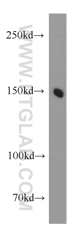 WB analysis of HepG2 using 20069-1-AP