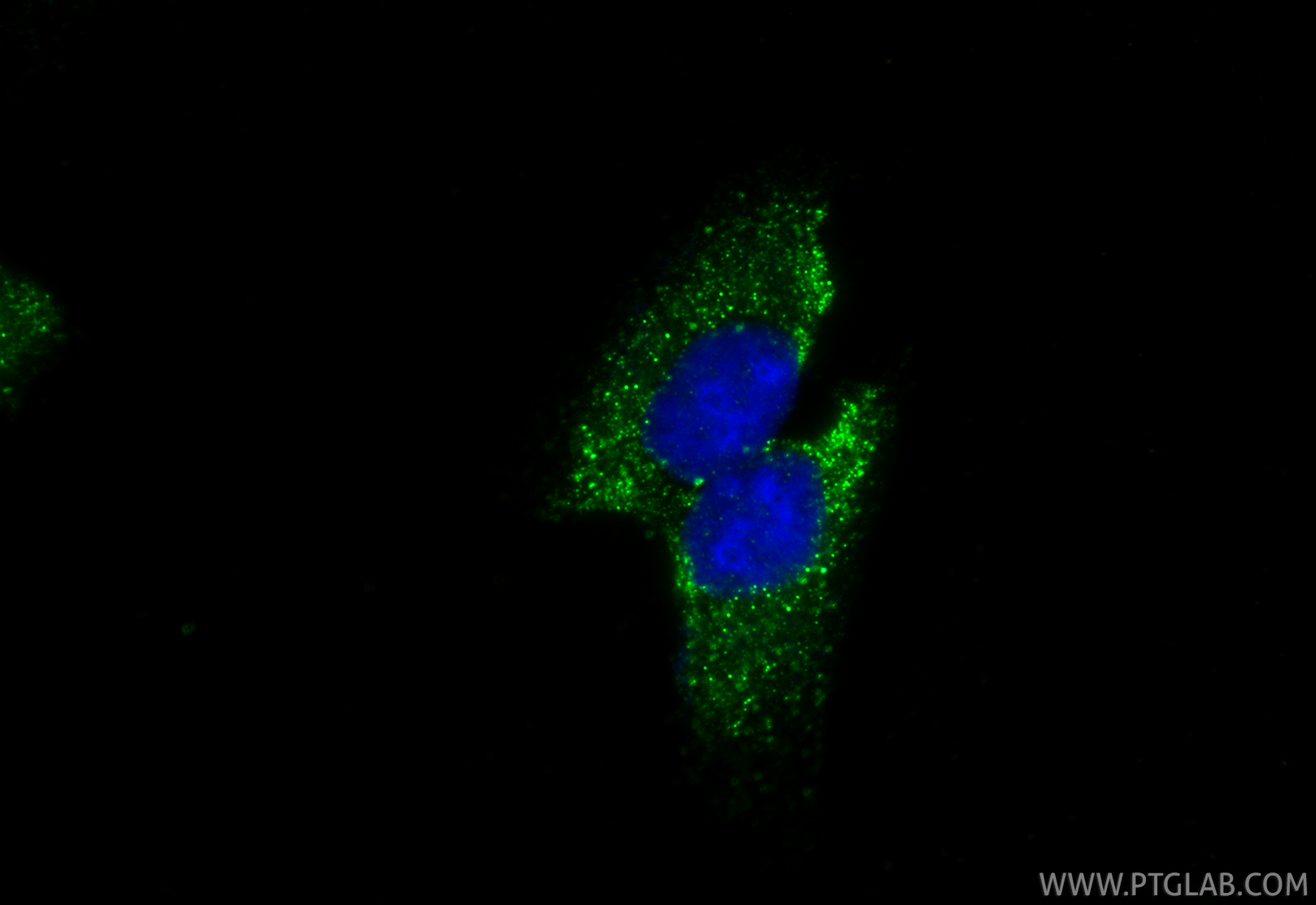 IF Staining of U2OS using 34123-1-AP (same clone as 34123-1-PBS) IF Staining of U2OS using 34123-1-AP (same clone as 34123-1-PBS)