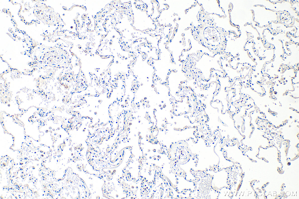 IHC staining of human lung using 34123-1-AP