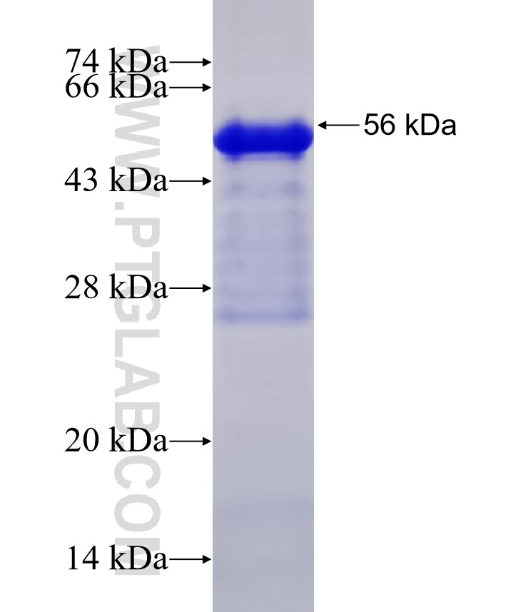 PCDH19 fusion protein Ag32302 SDS-PAGE PCDH19 fusion protein Ag32302 SDS-PAGE