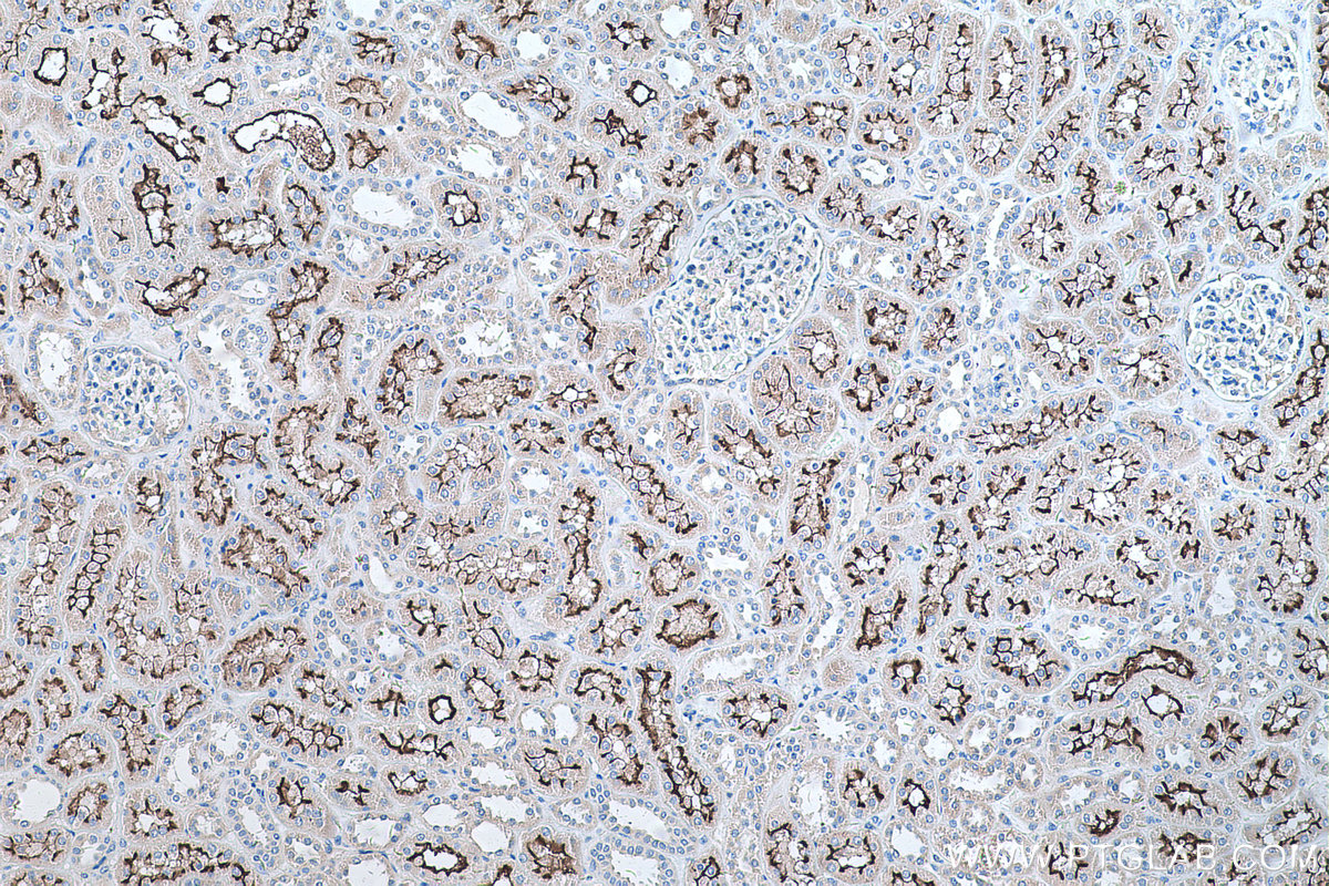 IHC staining of human kidney using 27103-1-AP