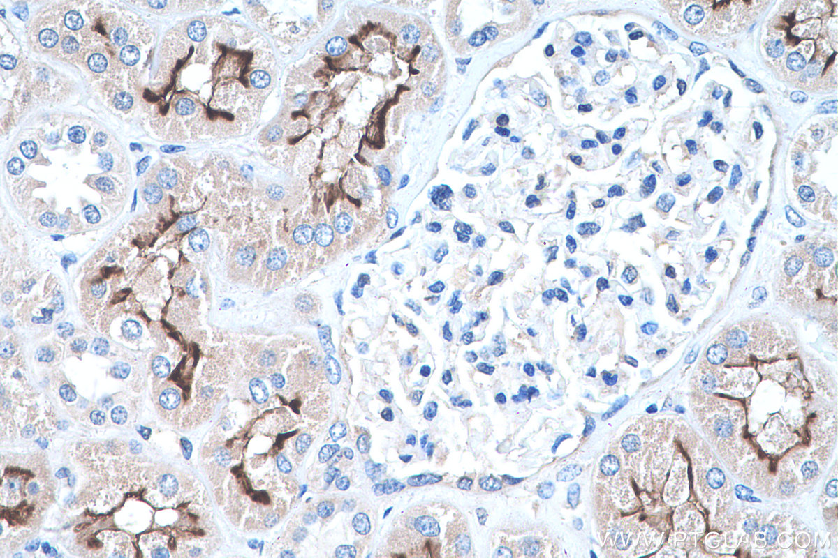 IHC staining of human kidney using 27103-1-AP