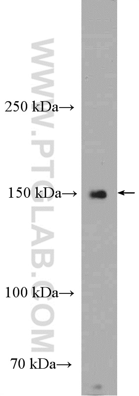 WB analysis of mouse liver using 27103-1-AP