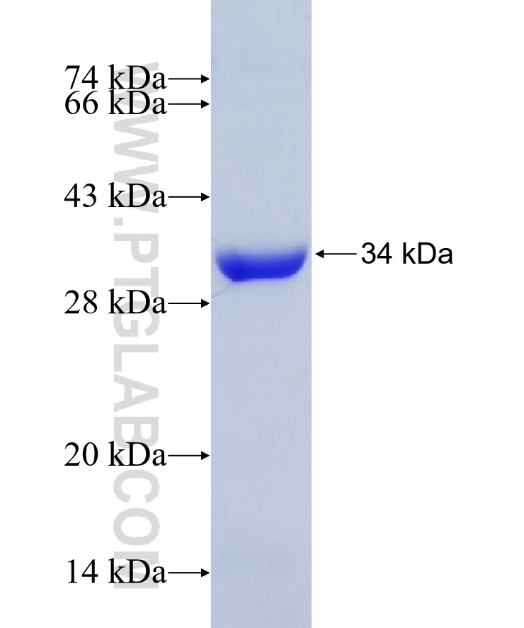 PCDH24 fusion protein Ag25871 SDS-PAGE PCDH24 fusion protein Ag25871 SDS-PAGE