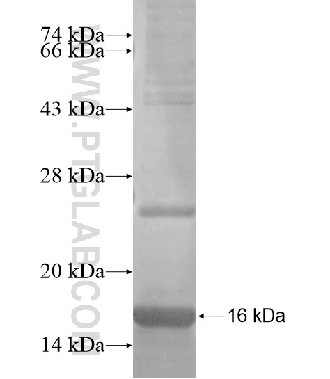 PCDH9 fusion protein Ag19892 SDS-PAGE PCDH9 fusion protein Ag19892 SDS-PAGE