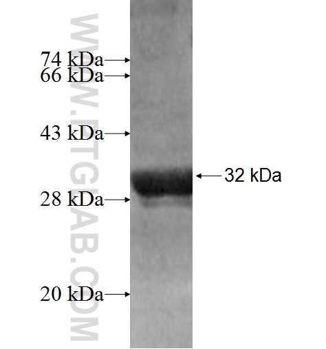 PCDHA6 fusion protein Ag8300 SDS-PAGE PCDHA6 fusion protein Ag8300 SDS-PAGE