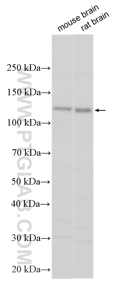 Various lysates were subjected to SDS PAGE followed by western blot with 18211-1-AP (PCDHAC2 antibody) at dilution of 1:1000 incubated at room temperature for 1.5 hours. WB analysis using 18211-1-AP