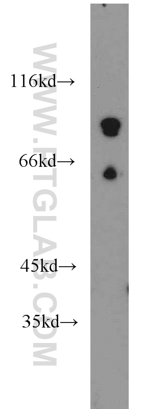 WB analysis of mouse brain using 14020-1-AP (same clone as 14020-1-PBS)