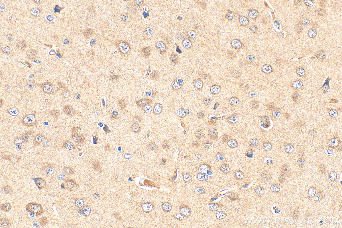 IHC staining of mouse brain using 17050-1-AP