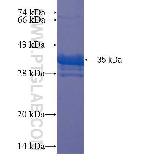 PCDHB14 fusion protein Ag22859 SDS-PAGE PCDHB14 fusion protein Ag22859 SDS-PAGE