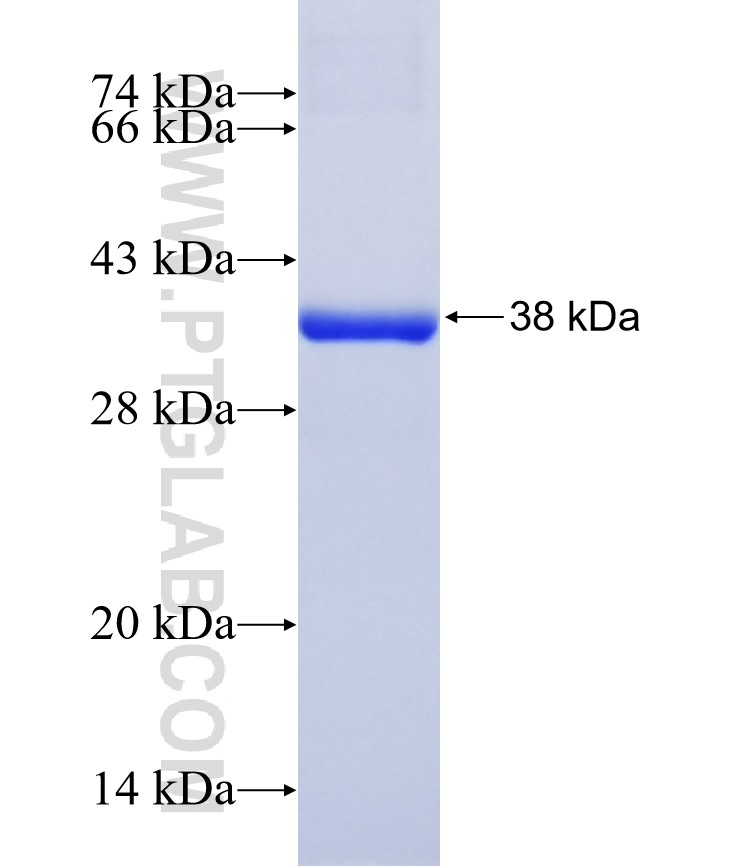 PCDHB2 fusion protein Ag16065 SDS-PAGE PCDHB2 fusion protein Ag16065 SDS-PAGE