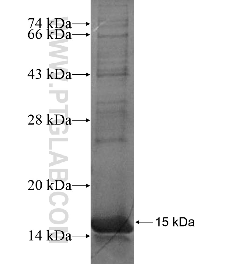 PCDHB4 fusion protein Ag17339 SDS-PAGE PCDHB4 fusion protein Ag17339 SDS-PAGE