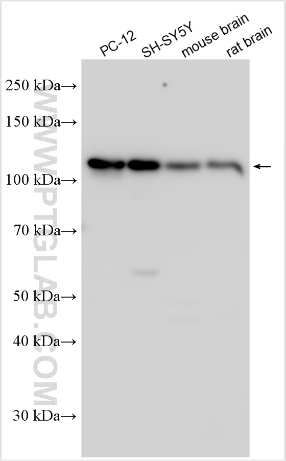 WB analysis using 18279-1-AP
