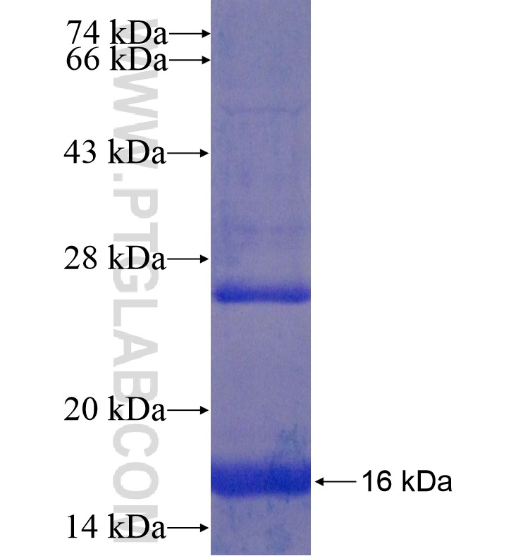 PCDHGA6 fusion protein Ag16629 SDS-PAGE PCDHGA6 fusion protein Ag16629 SDS-PAGE