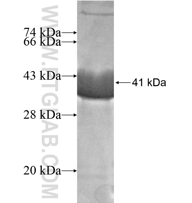 PCDHGB1 fusion protein Ag16860 SDS-PAGE PCDHGB1 fusion protein Ag16860 SDS-PAGE