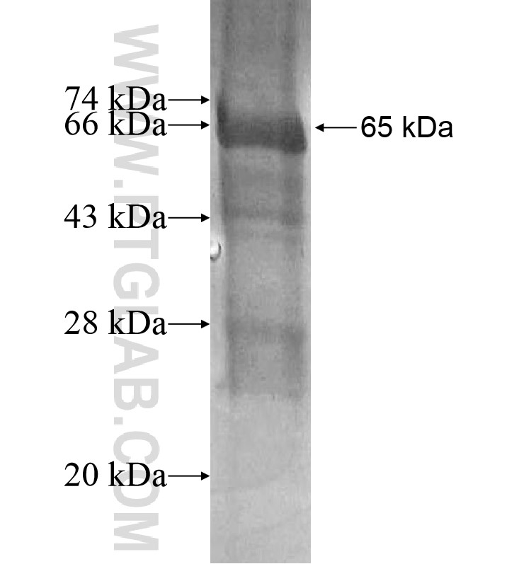 PCDHGB1 fusion protein Ag16429 SDS-PAGE PCDHGB1 fusion protein Ag16429 SDS-PAGE