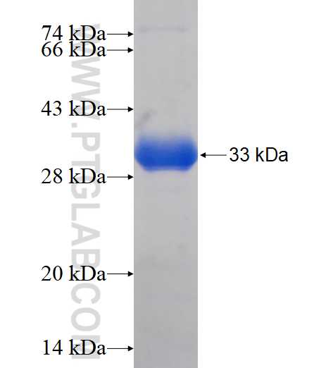 PCDHGB3 fusion protein Ag16620 SDS-PAGE PCDHGB3 fusion protein Ag16620 SDS-PAGE