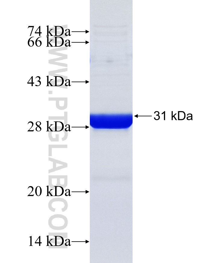 PCDHGB6 fusion protein Ag20314 SDS-PAGE PCDHGB6 fusion protein Ag20314 SDS-PAGE
