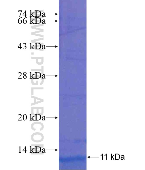 PCDHGB6 fusion protein Ag20480 SDS-PAGE PCDHGB6 fusion protein Ag20480 SDS-PAGE