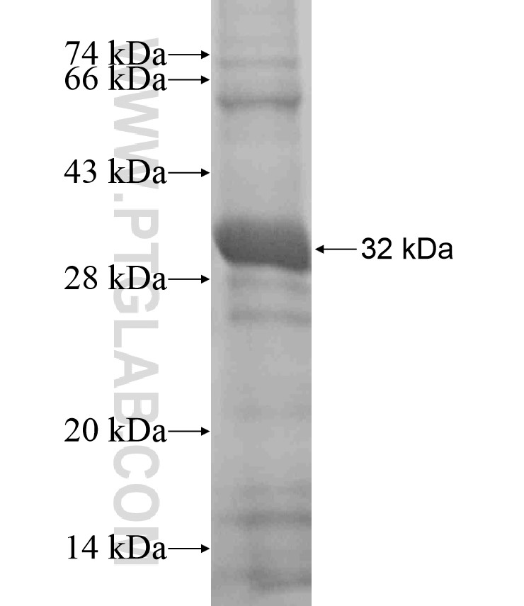 PCDHGC4 fusion protein Ag16986 SDS-PAGE PCDHGC4 fusion protein Ag16986 SDS-PAGE
