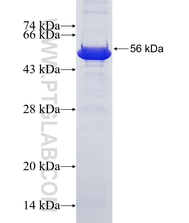 PCDHGC5 fusion protein Ag20867 SDS-PAGE PCDHGC5 fusion protein Ag20867 SDS-PAGE