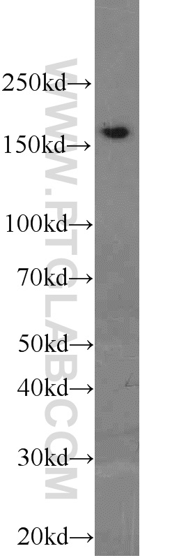 WB analysis of K-562 using 23540-1-AP