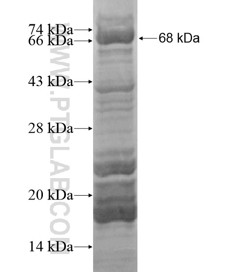 PCF11 fusion protein Ag20129 SDS-PAGE PCF11 fusion protein Ag20129 SDS-PAGE